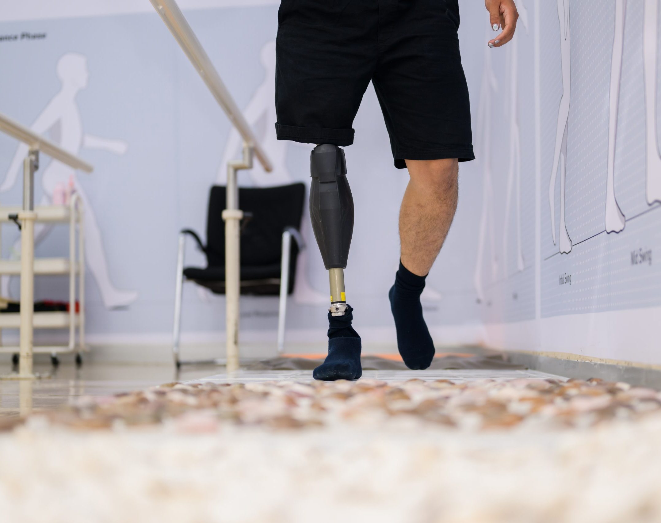 Prosthetics